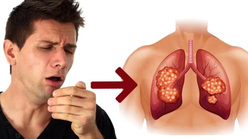 Ho kéo dài không khỏi có thể được phân loại theo thời gian và cần đánh giá dựa trên triệu chứng đi kèm.